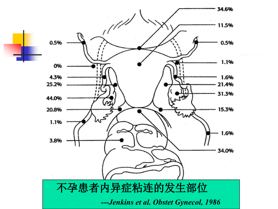 子宫内膜异位症与不育田秦杰_第3页