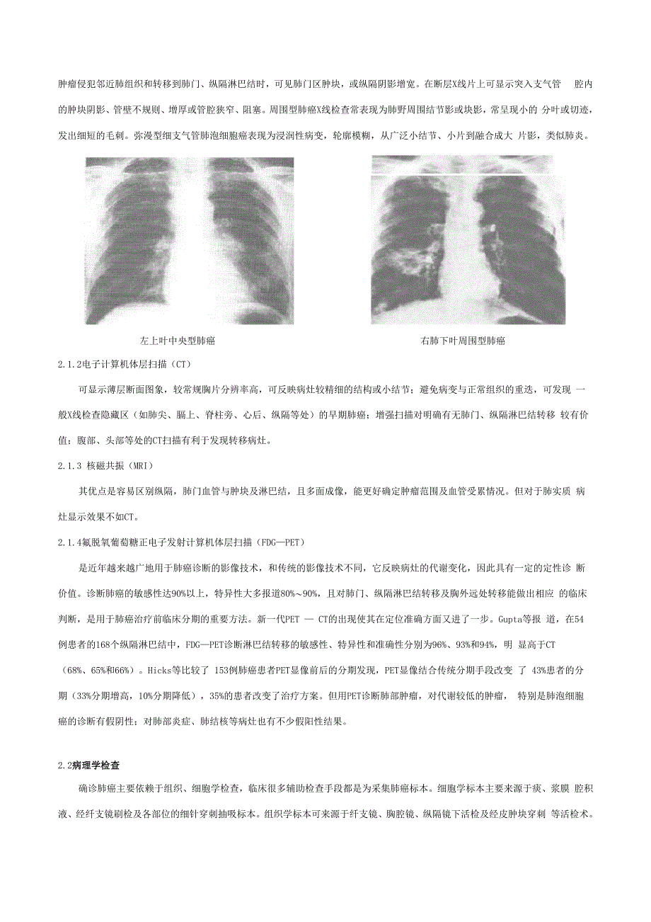 肺癌的诊断_第3页