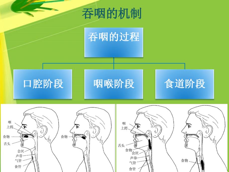 如何让吞咽困难患者安全进餐_第3页