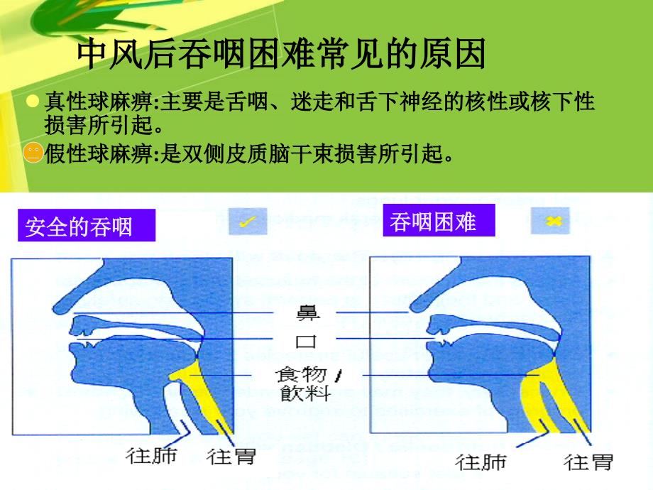 如何让吞咽困难患者安全进餐_第4页