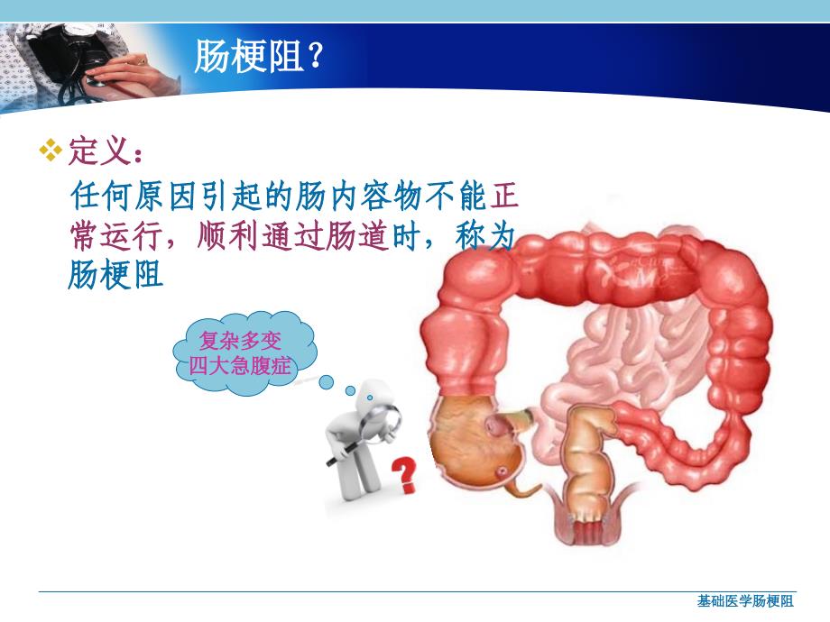 基础医学肠梗阻课件_第3页