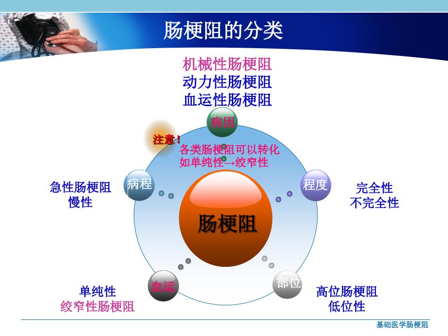 基础医学肠梗阻课件_第4页