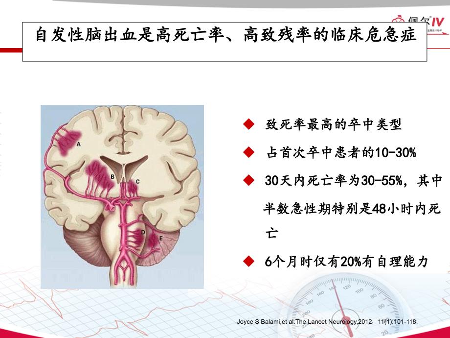 神经重症患者ICH血压管理指南解读PPT课件_第1页