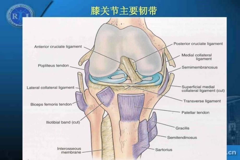 36膝关节韧带损伤的MR诊断丁晓毅dxy_第5页