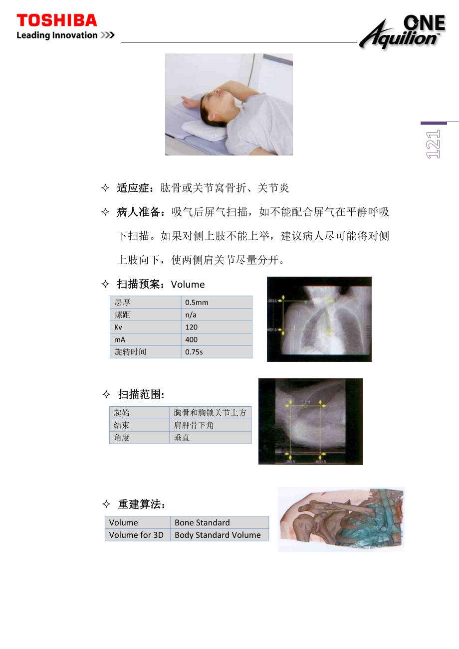 东芝320CT操作手册---11.骨关节的临床应用_第2页