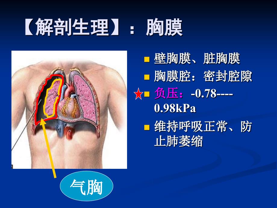 胸部损伤病人的护理.ppt_第4页