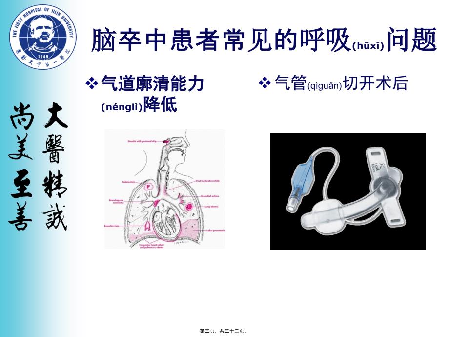 脑卒中呼吸训练课件_第3页