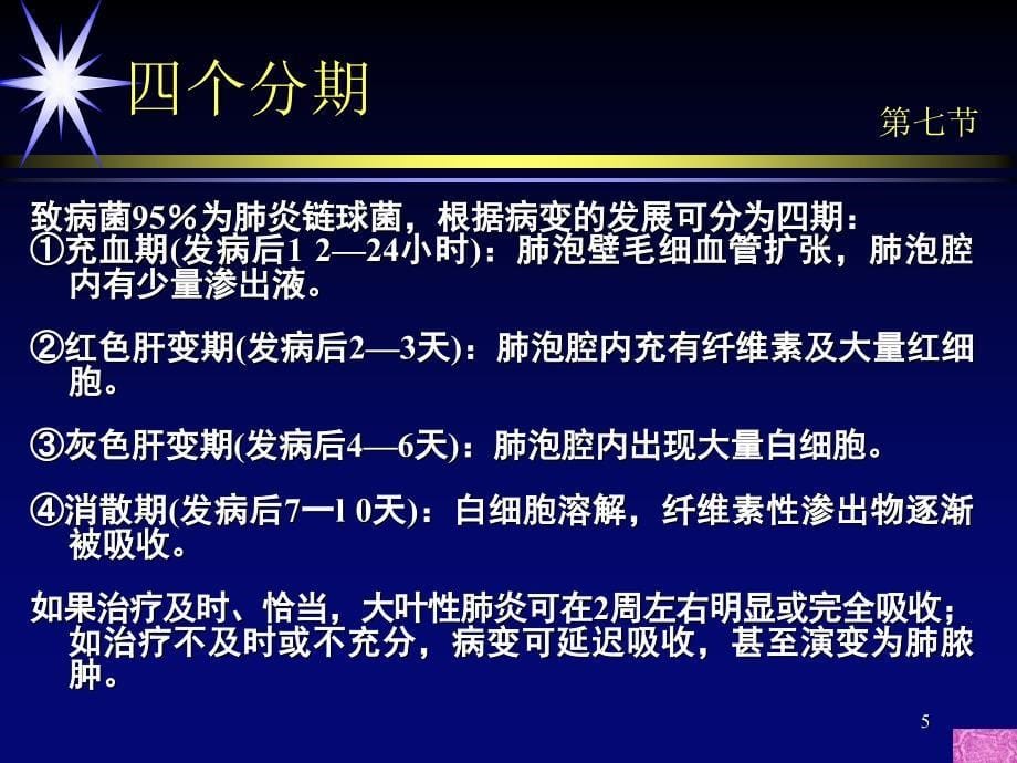 医学PPT课件大叶性肺炎诊断和鉴别诊断_第5页