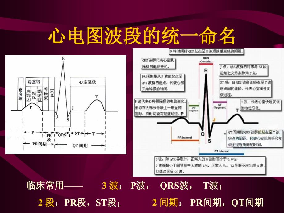 最新心电图心电向量与心肌缺血PPT课件_第2页