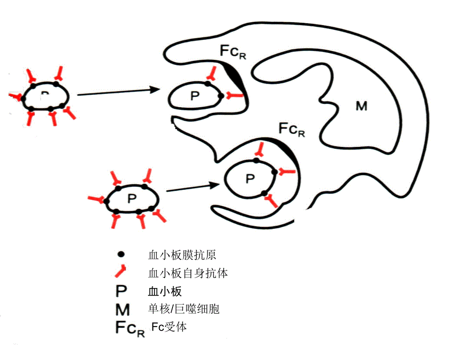 特发血小板减少紫癜_第4页