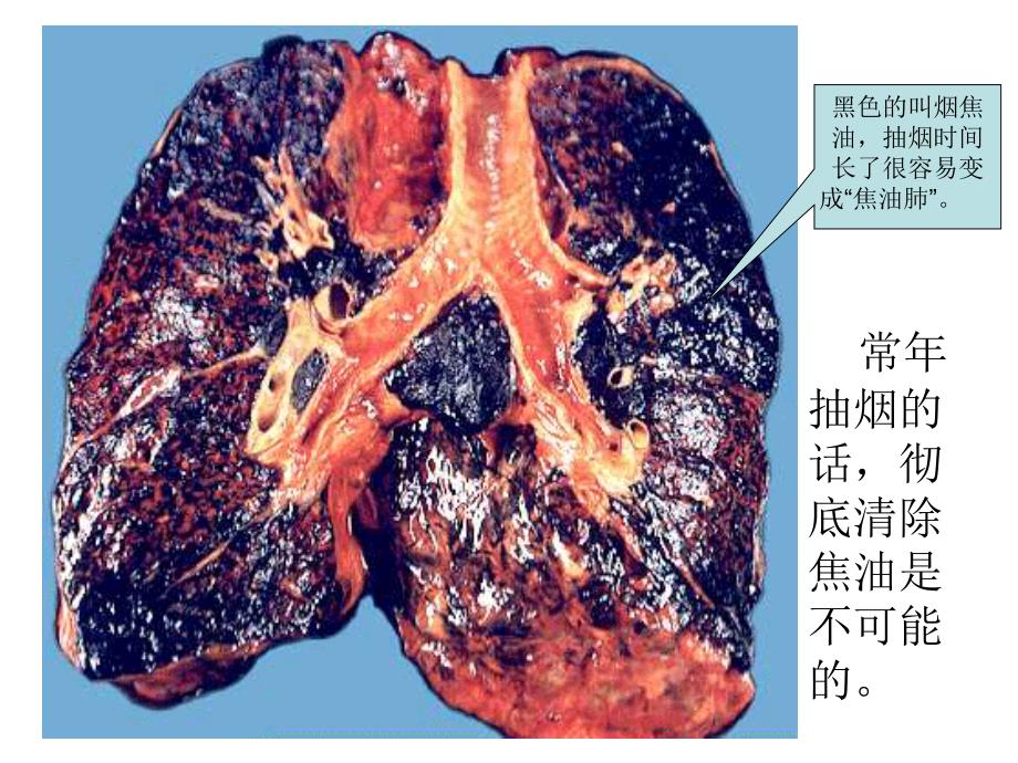 初中生健康教育-吸烟有害健康.ppt_第3页