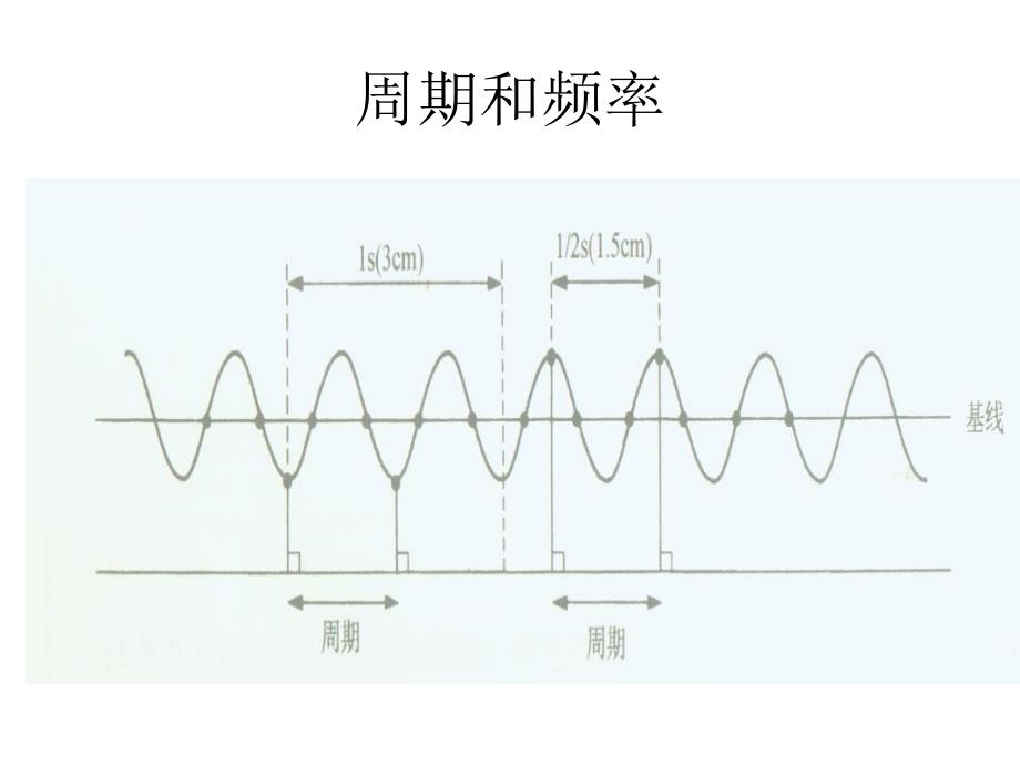 《脑电图读写规范》主讲翟怡宣武医院神经内科_第4页