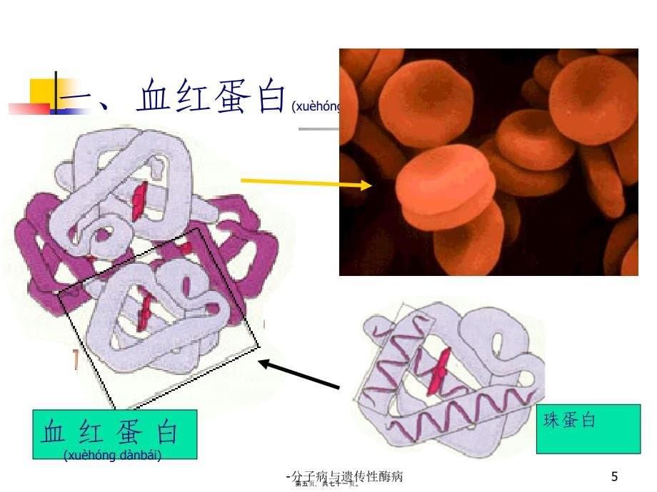 分子病与遗传性酶病课件_第5页