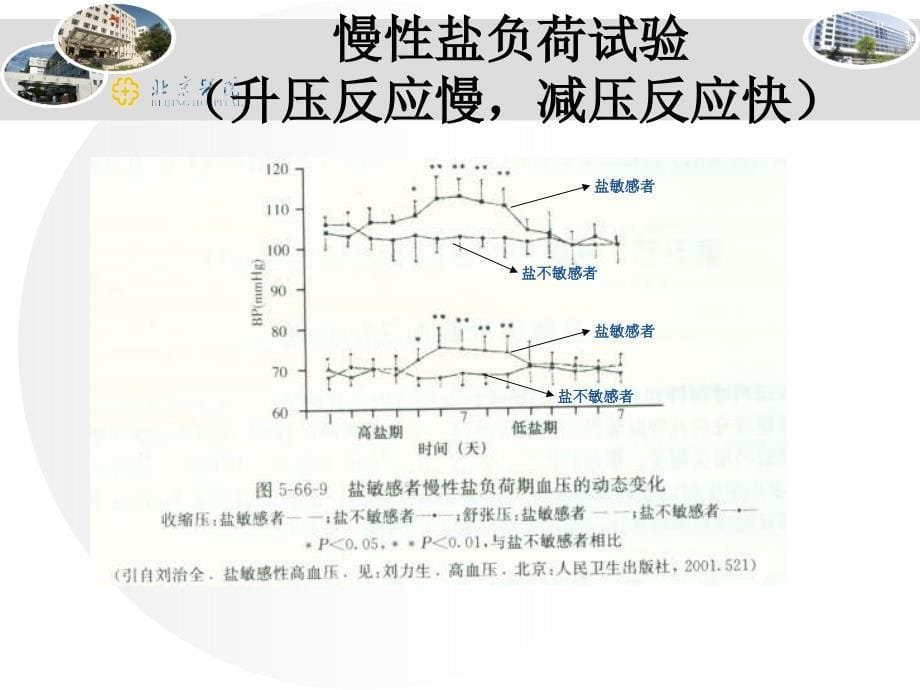 盐敏感性高血压刘德平_第5页