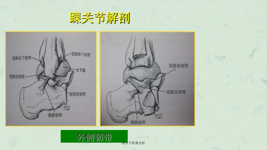 踝关节影像诊断课件_第3页