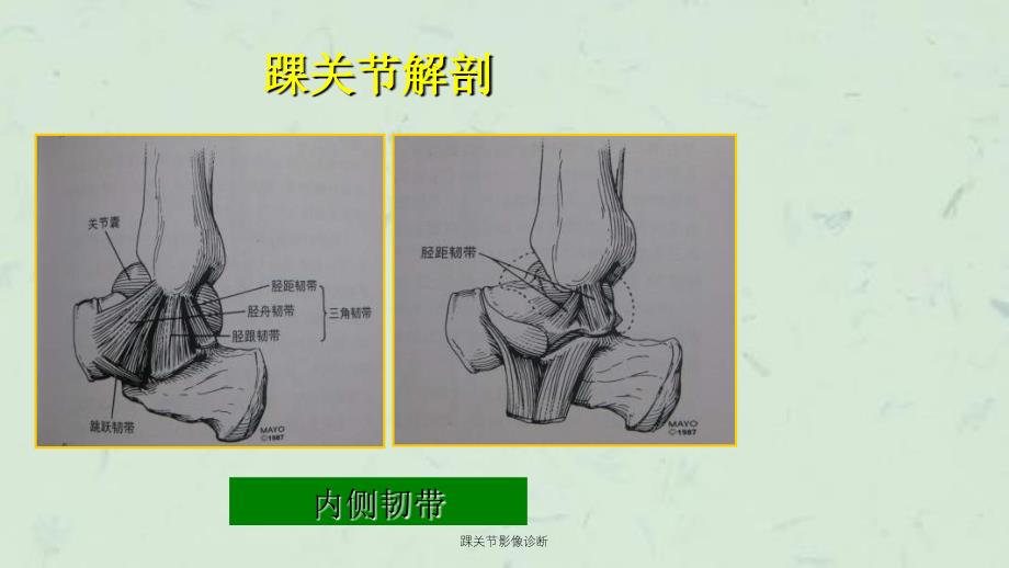 踝关节影像诊断课件_第4页