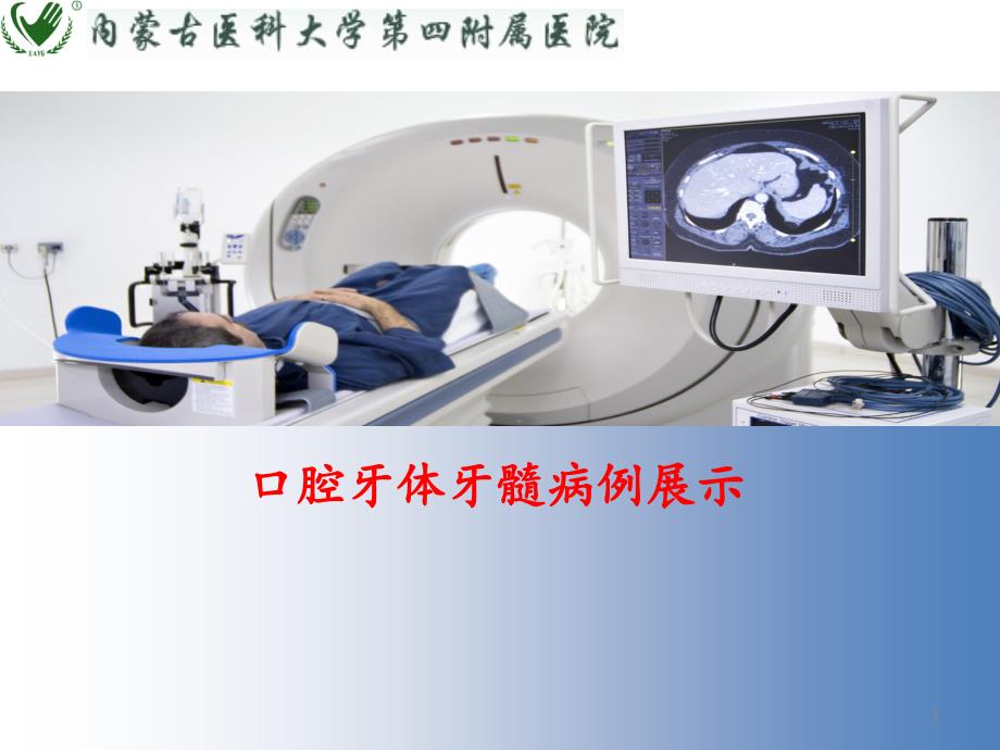 口腔牙体牙髓病例展示ppt课件_第1页