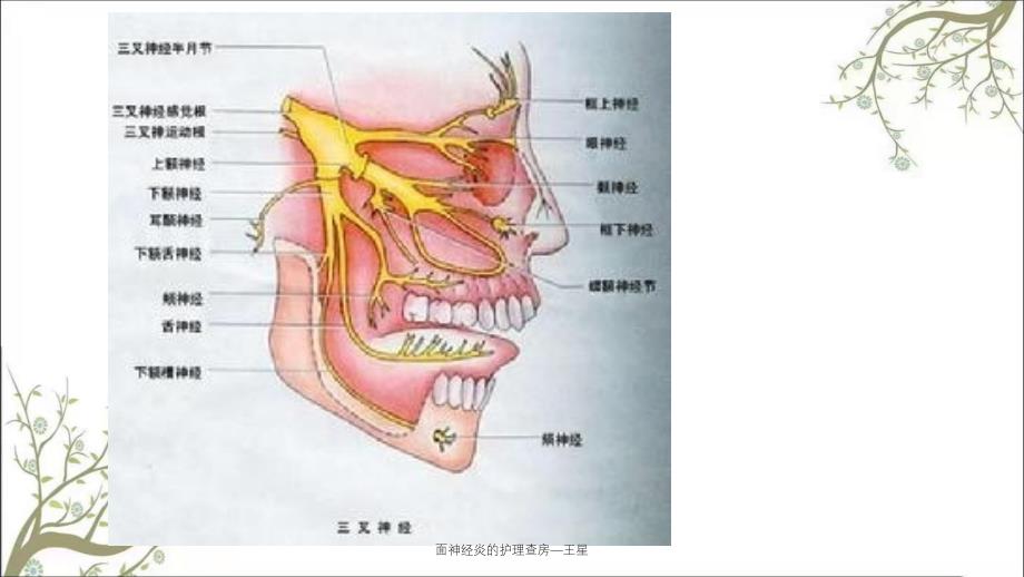 面神经炎的护理查房王星课件_第4页