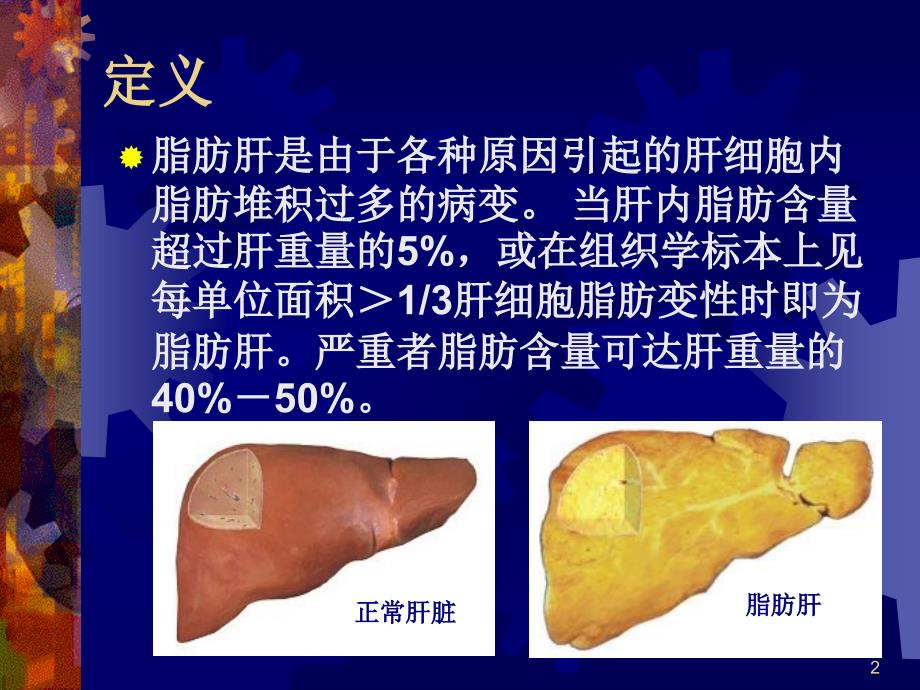 推荐精选脂肪肝的营养治疗_第2页