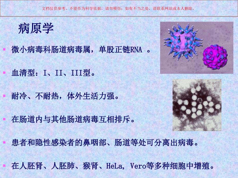 脊髓灰质炎专业知识培训课件_第3页