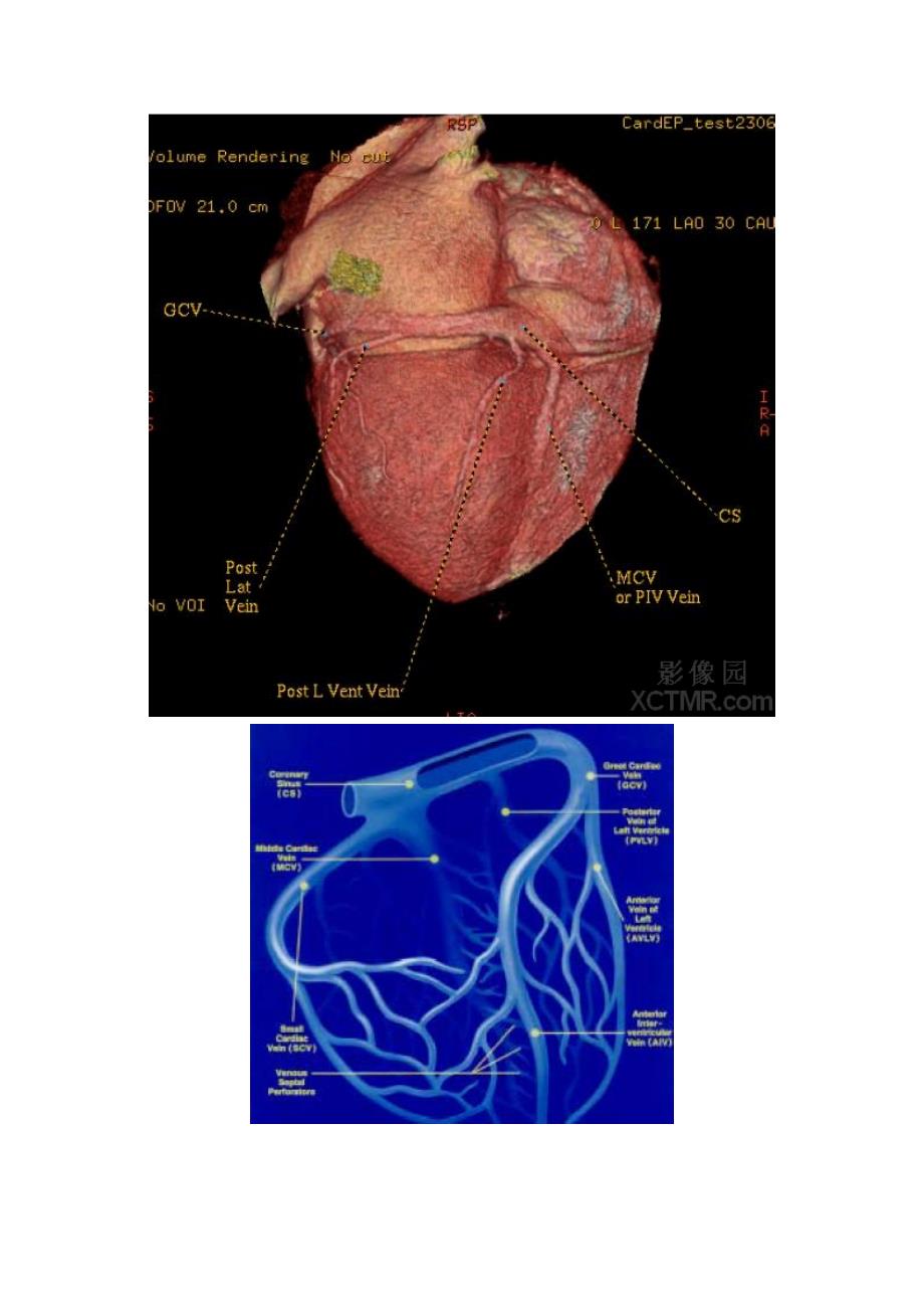 心脏CT解剖图谱_第2页