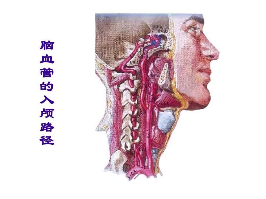 脑血管病-神经内科课件_第5页