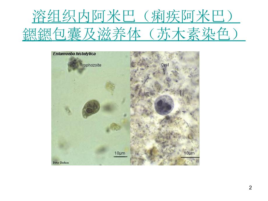 推荐精选最全常见寄生虫图谱_第2页