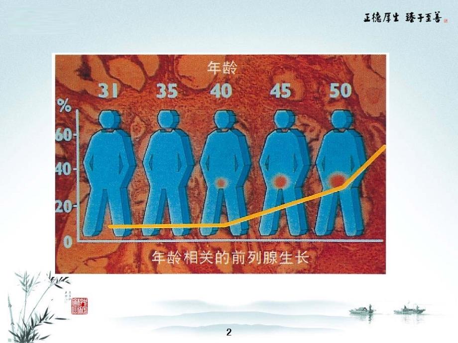 前列腺增生护理PPTPPT文档_第4页