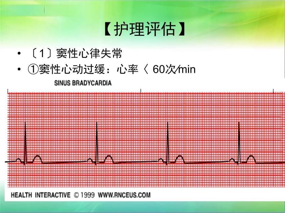 心律失常病人的护理查房PPT课件_第5页