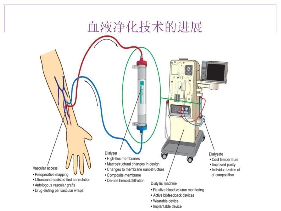 2014血液透析健康教育-肾友会.ppt_第5页