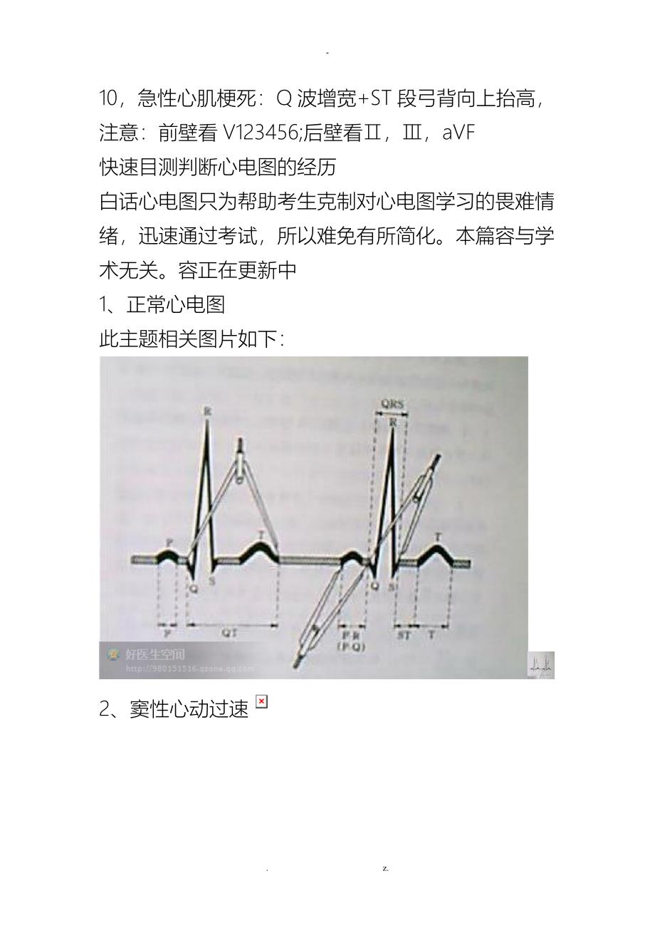 心电图的记忆方法~~!收藏着_第3页