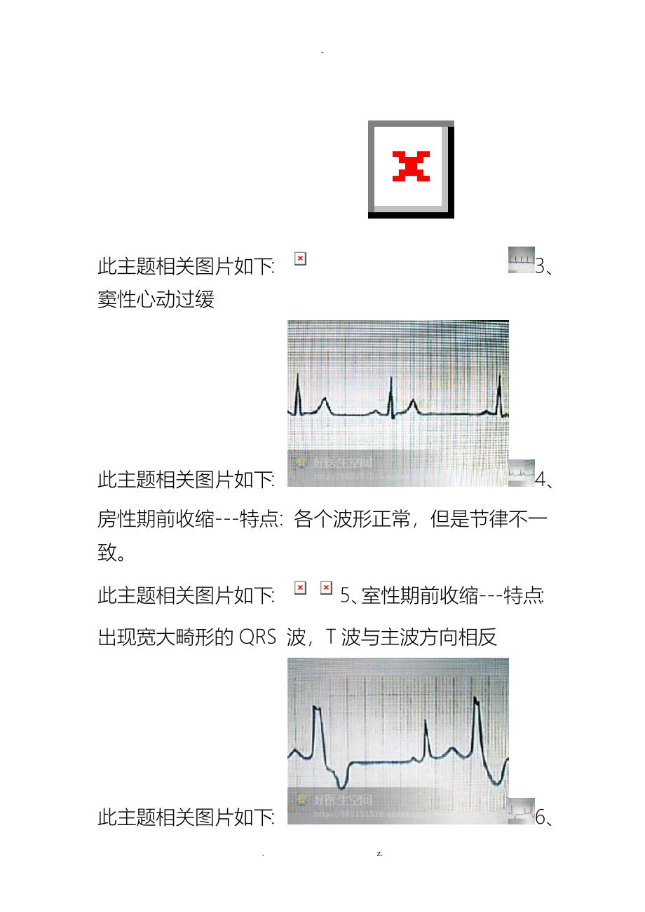 心电图的记忆方法~~!收藏着_第4页