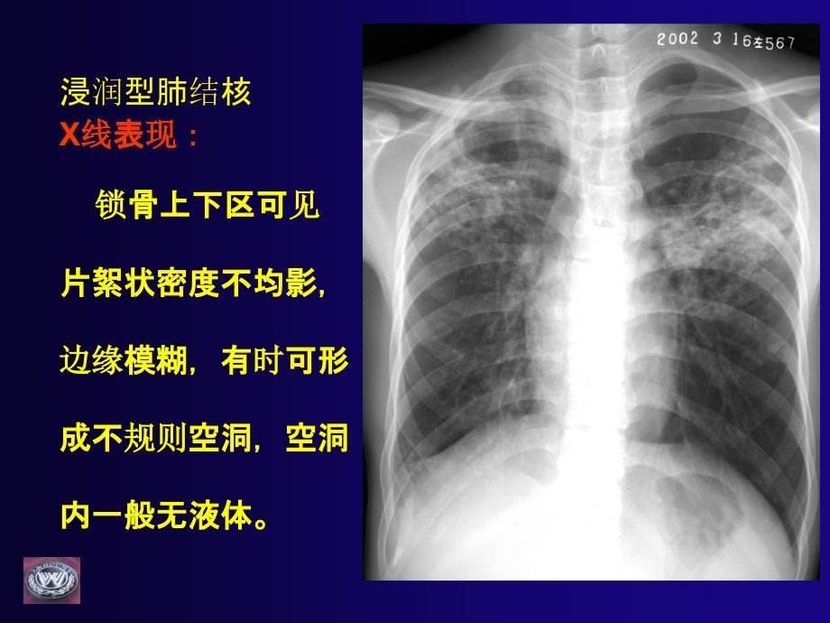 脊椎教学读片基础_第5页