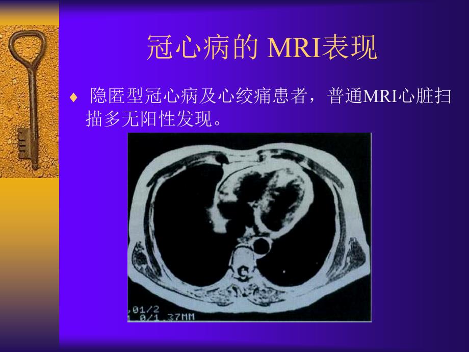 《心脏与大血管》PPT课件_第2页