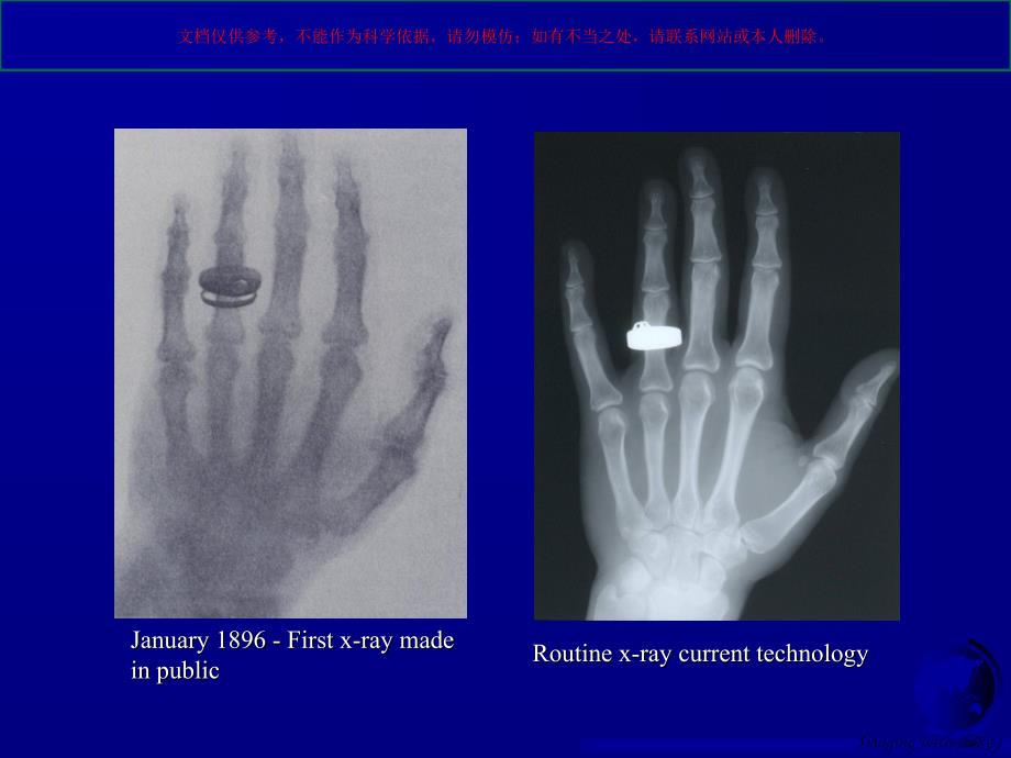 医学影像学发展与外科实践培训课件_第4页