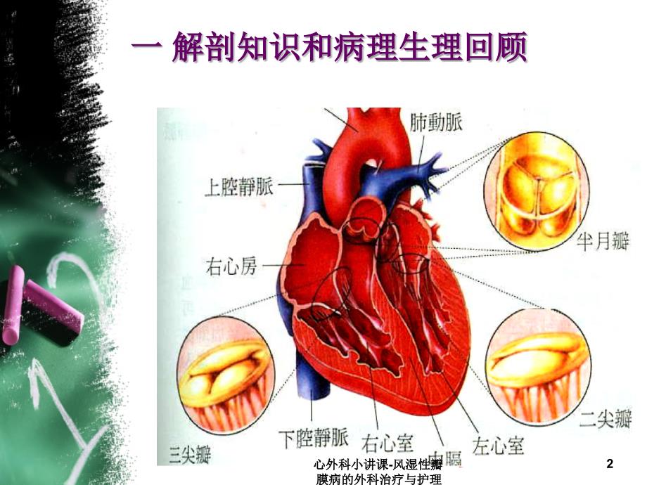 心外科小讲课风湿性瓣膜病的外科治疗与护理课件_第2页