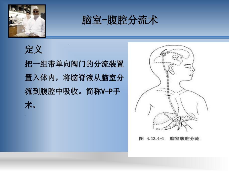 脑室腹腔分流术护理查房优秀课件_第2页