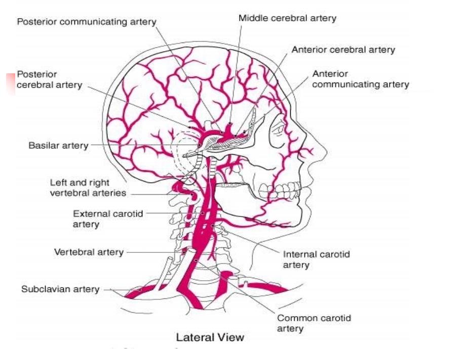 脑出血intracerebralhaemorrhageICH_第4页