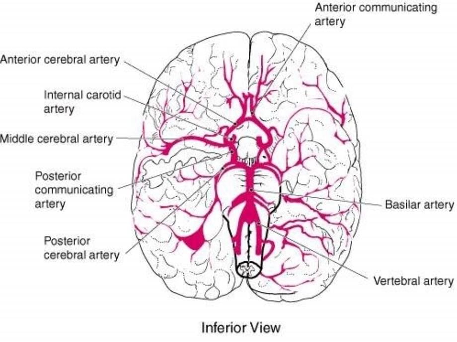 脑出血intracerebralhaemorrhageICH_第5页