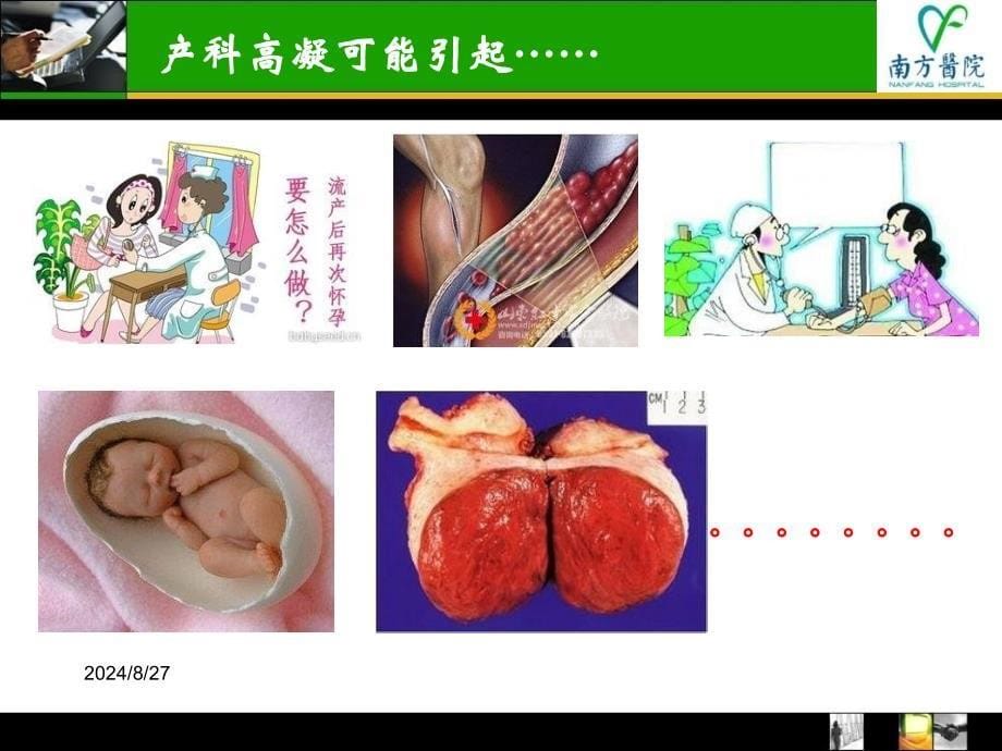 低分子肝素在产科的应用_第5页