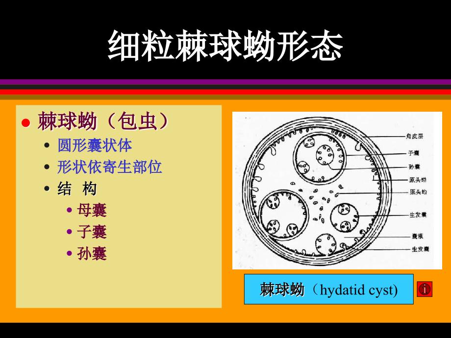 医学专题：棘球蚴病ok_第4页