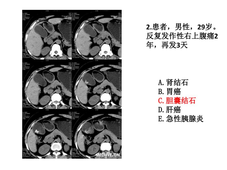 住院医师规陪出科考试辅助检查1_第2页