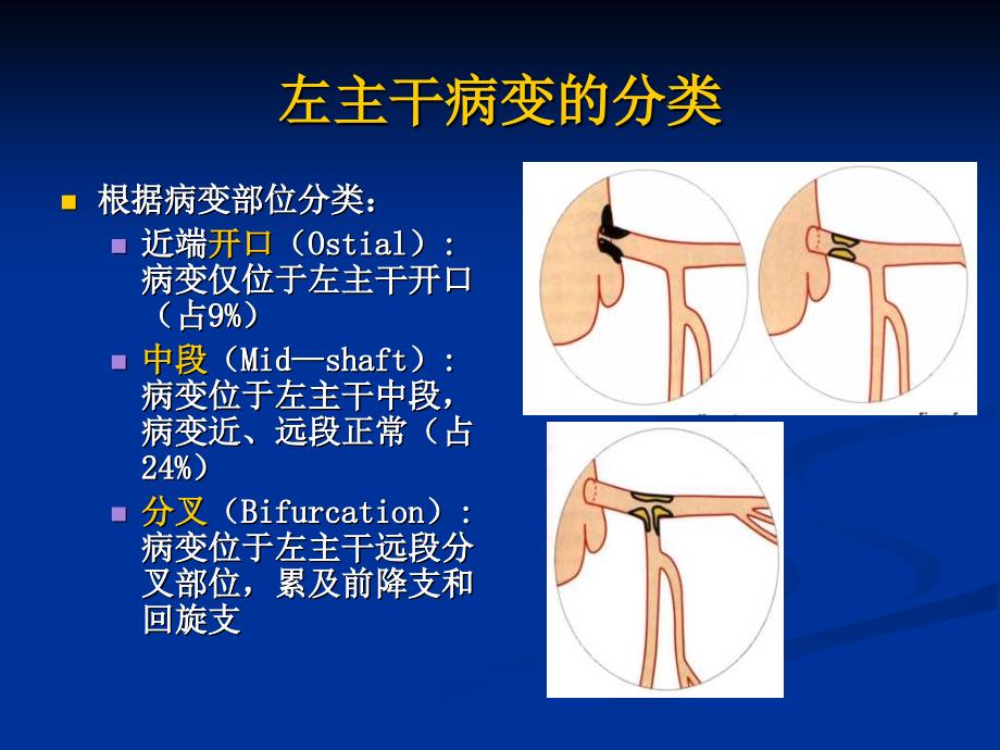 处理lm的基本pci策略_第3页