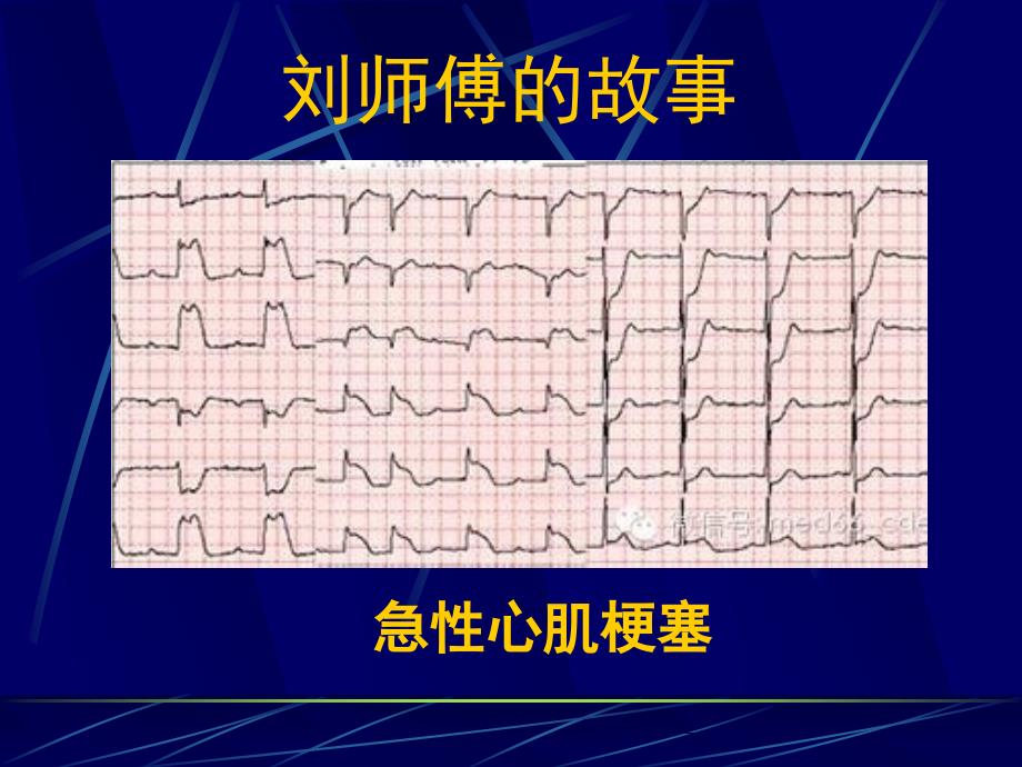 奇妙的介入治疗最终版pp课件_第3页