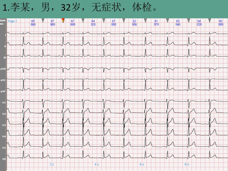 截屏图纸ppt课件_第1页