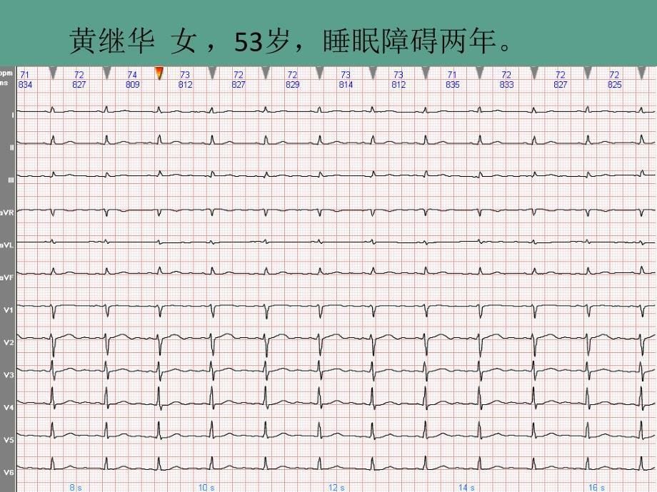 截屏图纸ppt课件_第5页