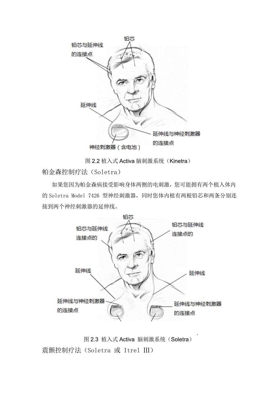 美敦力神经刺激器中文用户手册_第5页