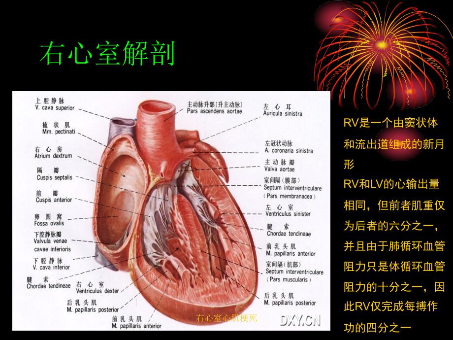 右心室心肌梗死课件_第3页