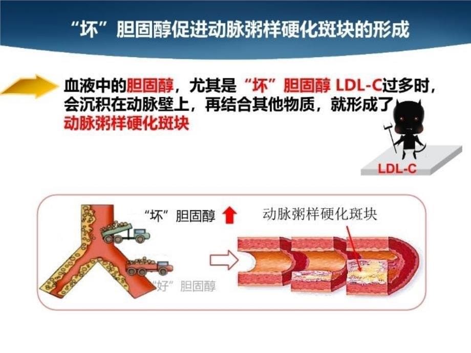 最新如何看懂血脂化验单ppt课件_第5页