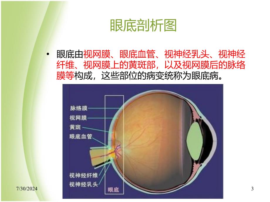 眼底病部分详解课件_第3页